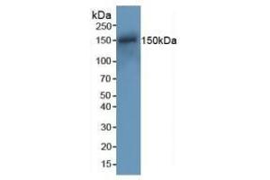 Detection of RAD50 in Mouse Spleen Tissue using Polyclonal Antibody to DNA Repair Protein RAD50 (RAD50) (RAD50 抗体  (AA 1-234))