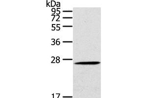 Western Blot analysis of Mouse liver tissue using CLEC4A Polyclonal Antibody at dilution of 1:100 (CLEC4A 抗体)