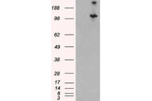 Western Blotting (WB) image for anti-Tuberous Sclerosis 1 (TSC1) (C-Term) antibody (ABIN2466406) (TSC1 抗体  (C-Term))