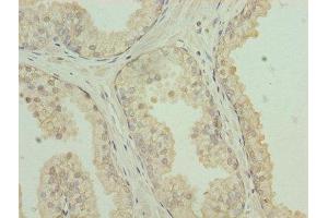 Immunohistochemistry (IHC) image for anti-C-Type Lectin Domain Family 3, Member A (CLEC3A) (AA 23-197) antibody (ABIN7146065)