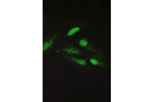 IF analysis of SRI using anti-SRI antibody (ABIN6719388) SRI was detected in immunocytochemical section of U20S cell. (SRI 抗体)