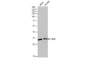 Western Blotting (WB) image for anti-Deoxycytidine Kinase (DCK) antibody (ABIN2855484)