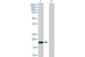 Western Blot analysis of NUDT2 expression in transfected 293T cell line by NUDT2 MaxPab polyclonal antibody. (NUDT2 抗体  (AA 1-147))