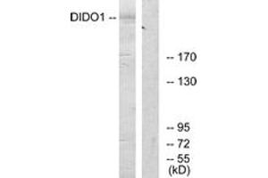 Western blot analysis of extracts from 293 cells, using DIDO1 Antibody. (DIDO1 抗体  (AA 161-210))