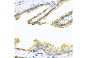 Immunohistochemistry of paraffin-embedded human prostate using PENK antibody. (Enkephalin 抗体)