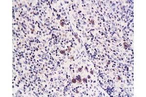 Formalin-fixed and paraffin embedded rat transplant lymphoma labeled with Anti-Caspase-1 Polyclonal Antibody, Unconjugated  at 1:200 followed by conjugation to the secondary antibody and DAB staining (Caspase 1 (p10) 抗体  (AA 320-404))