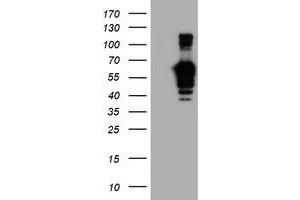 Western Blotting (WB) image for anti-Golgi Membrane Protein 1 (GOLM1) antibody (ABIN1498494) (GOLM1 抗体)