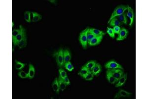 Immunofluorescence staining of HepG2 cells with ABIN7157976 at 1:100, counter-stained with DAPI. (LEMD1 抗体  (AA 44-151))