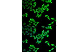 Immunofluorescence analysis of U2OS cells using TRIP10 antibody. (TRIP10 抗体  (AA 246-545))