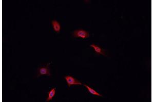 Immunofluorescence (fixed cells) (IF/ICC) image for anti-Signal Transducer and Activator of Transcription 3 (Acute-Phase Response Factor) (STAT3) (C-Term) antibody (ABIN6265317)