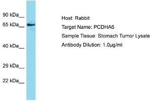 Host: Rabbit Target Name: PCDHA6 Sample Type: Stomach Tumor lysates Antibody Dilution: 1. (PCDHA6 抗体  (N-Term))