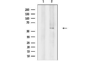 anti-POTE Ankyrin Domain Family, Member B (POTEB) (C-Term) antibody