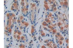 DAB staining on IHC-P; Samples: Human Stomach Tissue (IRAK2 抗体  (AA 235-521))