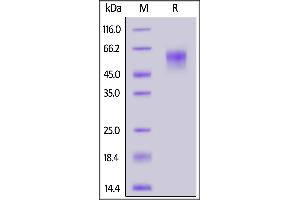 SDS-PAGE (SDS) image for SARS-CoV-2 Spike S1 (B.1.351 - beta) (Active) protein (His tag) (ABIN6992377)