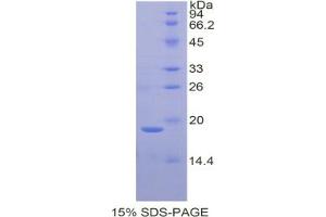 SDS-PAGE analysis of Rat Galectin 7 Protein. (LGALS7 蛋白)
