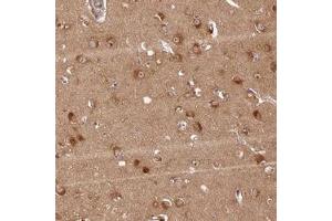 Immunohistochemical staining of human cerebral cortex with LRRC68 polyclonal antibody  shows strong cytoplasmic positivity in neuronal cells at 1:100-1:250 dilution.