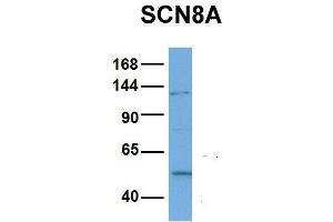 Western Blotting (WB) image for anti-Sodium Channel, Voltage-Gated, Type VIII, alpha (SCN8A) (Middle Region) antibody (ABIN2776199)