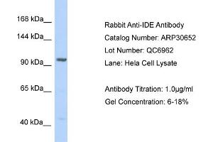WB Suggested Anti-IDE Antibody   Titration: 1. (IDE 抗体  (N-Term))