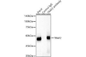 Immunoprecipitation analysis of 300 μg extracts of HeLa cells using 3 μg TR antibody . (TRAF2 抗体)