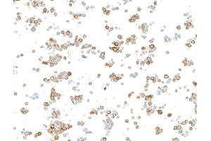 Immunocytochemistry (ICC) image for anti-Doublecortin (DCX) (AA 200-250) antibody (ABIN7453969) (Recombinant Doublecortin 抗体  (AA 200-250))