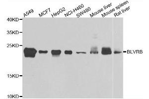 Western blot analysis of extracts of various cell lines, using BLVRB antibody. (BLVRB 抗体  (AA 1-206))