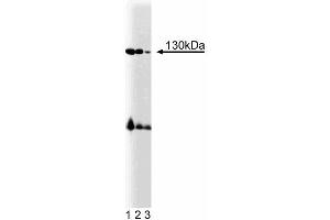 Western blot analysis of BMPR-II on mouse cerebrum lysate. (BMPR2 抗体  (AA 803-996))