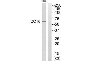 Western blot analysis of extracts from HeLa cells, using CCT8 antibody. (CCT8 抗体  (Internal Region))