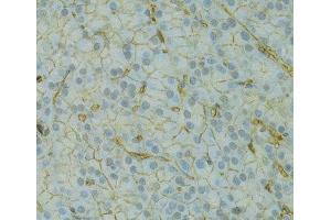 Immunohistochemistry of paraffin-embedded Rat pancreas using KCNJ1 Polyclonal Antibody at dilution of 1:100 (40x lens). (KCNJ1 抗体)