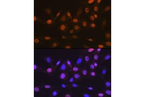 Immunofluorescence analysis of NIH-3T3 cells using T Rabbit mAb (ABIN7270729) at dilution of 1:100 (40x lens). (TARBP2 抗体)