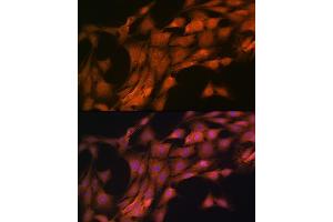 Immunofluorescence analysis of C6 cells using FKBP38/FKBP8 Rabbit mAb (ABIN7267214) at dilution of 1:100 (40x lens). (FKBP8 抗体)