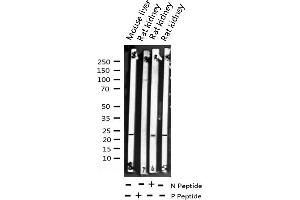 Western blot analysis of Phospho-Caveolin-1 (Tyr14) expression in various lysates (Caveolin-1 抗体  (pTyr14))