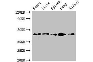 Western Blot Positive WB detected in: Mouse heart tissue, Mouse liver tissue, Mouse spleen tissue, Mouse lung tissue, Mouse kidney tissue All lanes: CD209 antibody at 4 μg/mL Secondary Goat polyclonal to rabbit IgG at 1/50000 dilution Predicted band size: 46, 36, 19, 44, 42, 31, 5, 38, 34 kDa Observed band size: 46 kDa (ITGB1 抗体  (AA 297-380))