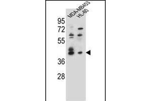SOX3 Antibody (Center) (ABIN655392 and ABIN2844940) western blot analysis in MDA-M,HL-60 cell line lysates (35 μg/lane). (SOX3 抗体  (AA 166-196))