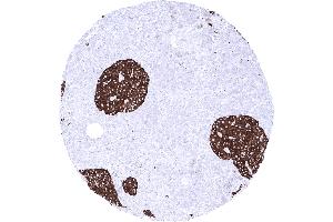 Pancreas A strong synaptophysin immunostaining is seen in islet cells of Langerhans (Recombinant Synaptophysin 抗体  (AA 274-313))