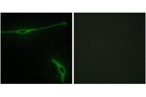 Immunofluorescence (IF) image for anti-Laminin, alpha 2 (LAMA2) (AA 2011-2060) antibody (ABIN2889999) (Laminin 抗体  (AA 2011-2060))