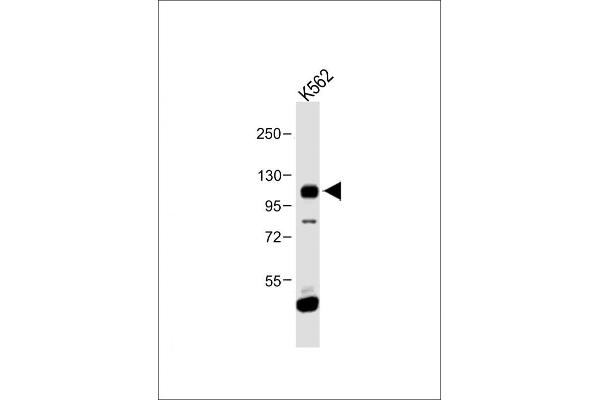 FGFR4 抗体  (N-Term)