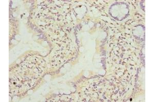 Immunohistochemistry of paraffin-embedded human small intestine tissue using ABIN7173167 at dilution of 1:100 (TMEM243 抗体  (AA 1-31))
