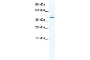 Western Blotting (WB) image for anti-DEAD (Asp-Glu-Ala-Asp) Box Polypeptide 49 (DDX49) antibody (ABIN2461354) (DDX49 抗体)