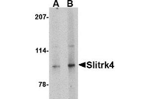 Western Blotting (WB) image for anti-SLIT and NTRK-Like Family, Member 4 (SLITRK4) (C-Term) antibody (ABIN1030684) (SLITRK4 抗体  (C-Term))