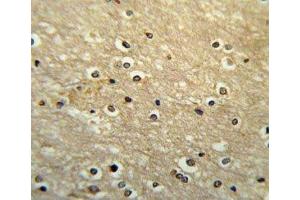 PAX-6 antibody immunohistochemistry analysis in formalin fixed and paraffin embedded human brain tissue (PAX6 抗体  (AA 352-380))