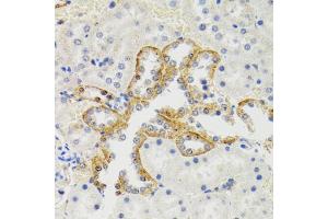 Immunohistochemistry of paraffin-embedded rat kidney using SH2B1 Antibody (ABIN5973245) at dilution of 1/100 (40x lens). (SH2B1 抗体)