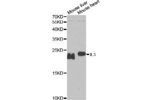 Western blot analysis of extracts of various cell lines, using IL3 antibody. (IL-3 抗体)