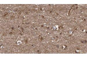 ABIN6279508 at 1/100 staining Human brain cancer tissue by IHC-P. (ICAM5 抗体)