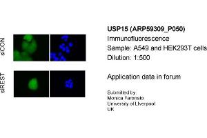 Immunofluorescence Sample Type: A549&HEK293T cellsPrimary Dilution: 1:500 (USP15 抗体  (C-Term))