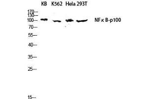 Western Blot (WB) analysis of KB K562 HeLa 293T lysis using NFkappaB-p100 antibody. (NFKB2 抗体  (Thr160))