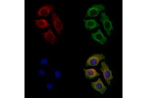 ABIN6263330 and ABIN6279544 staining Hela cells by IF/ICC.