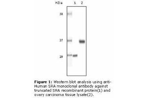 Image no. 2 for anti-Steroid Receptor RNA Activator 1 (SRA1) antibody (ABIN232100) (SRA1 抗体)