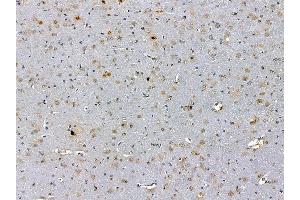 ABIN7095305 and ABIN7099362 at 1/100 staining rat brain tissue by IHC-P.