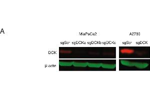 Western Blotting (WB) image for anti-Deoxycytidine Kinase (DCK) antibody (ABIN2855484)