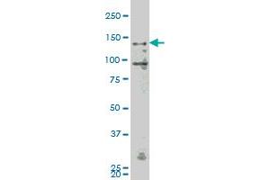 MAP4K4 monoclonal antibody (M07), clone 4A5 Western Blot analysis of MAP4K4 expression in K-562 . (MAP4K4 抗体  (AA 611-710))